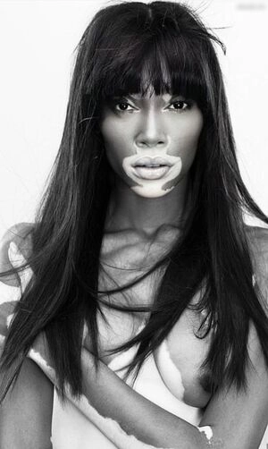 Winnie Harlow