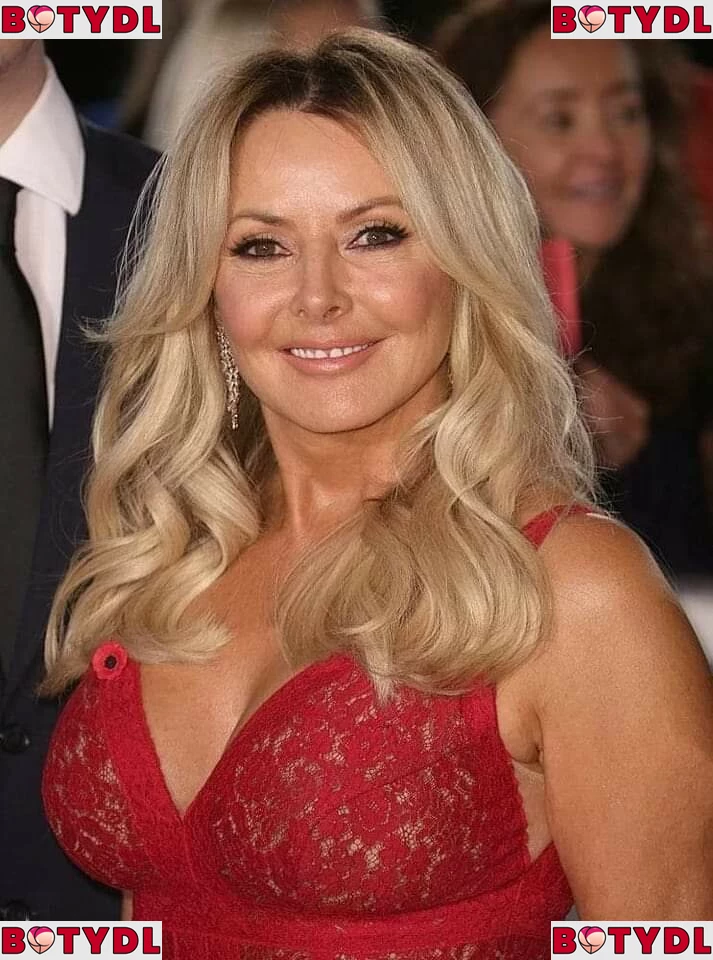 Carol Vorderman Onlyfans Photo Gallery 